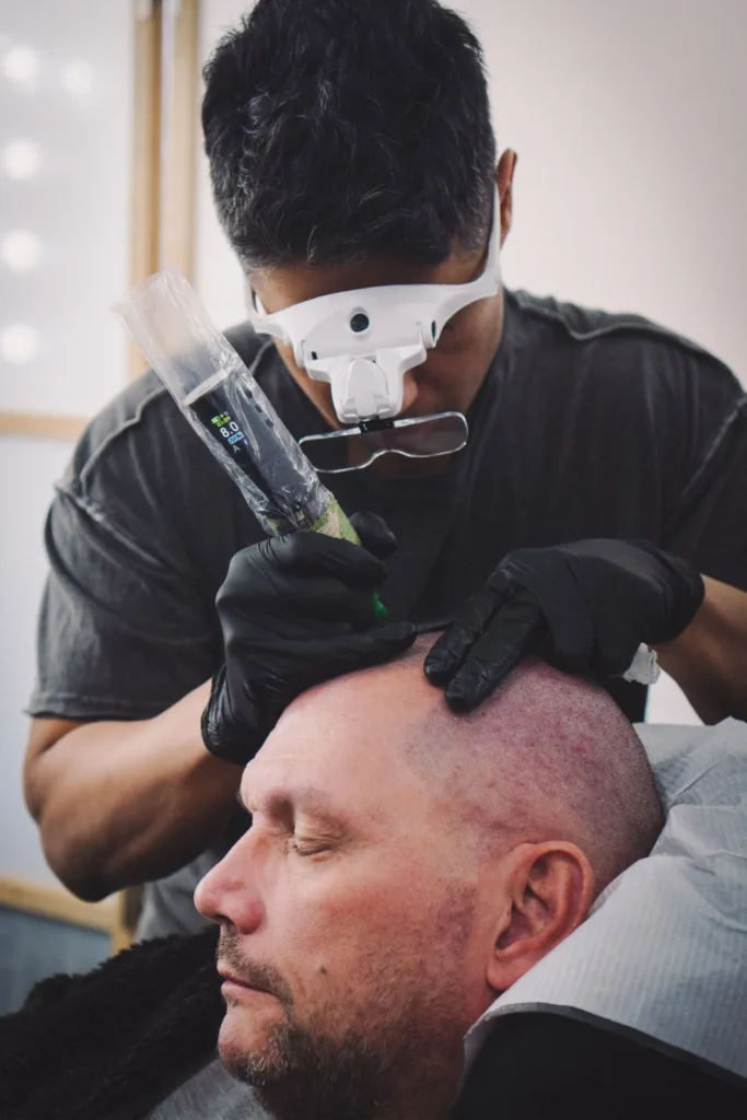 A technician using a fine pigment machine to apply scalp micropigmentation to a client's shaved head