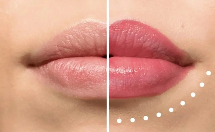 SEMI PERMANENT LIP BLUSH