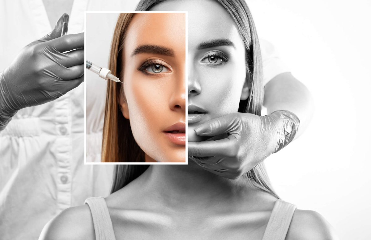 A skin booster being injected into a client's cheek at London Aesthetics